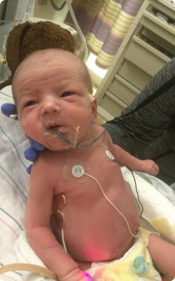 A picture of Finnegan in the NICU connected to tubes and monitors.