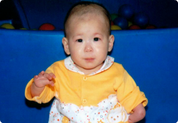 A picture of J a toddler girl who waits for adoption in Asia.