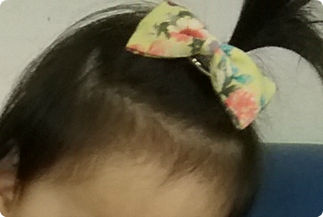A picture of a one-year-old girl's pony tail. We cannot share her photo due to privacy concerns from her country.