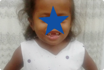A photo of D in a white dress with a star over her face to protect her privacy. She waits in Latin America for an adoptive family.