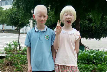 On International Albinism Awareness Day, get to know these twins. This brother and sister are pictured outside. The sister is holding up a peace sign with her fingers and making a funny face.